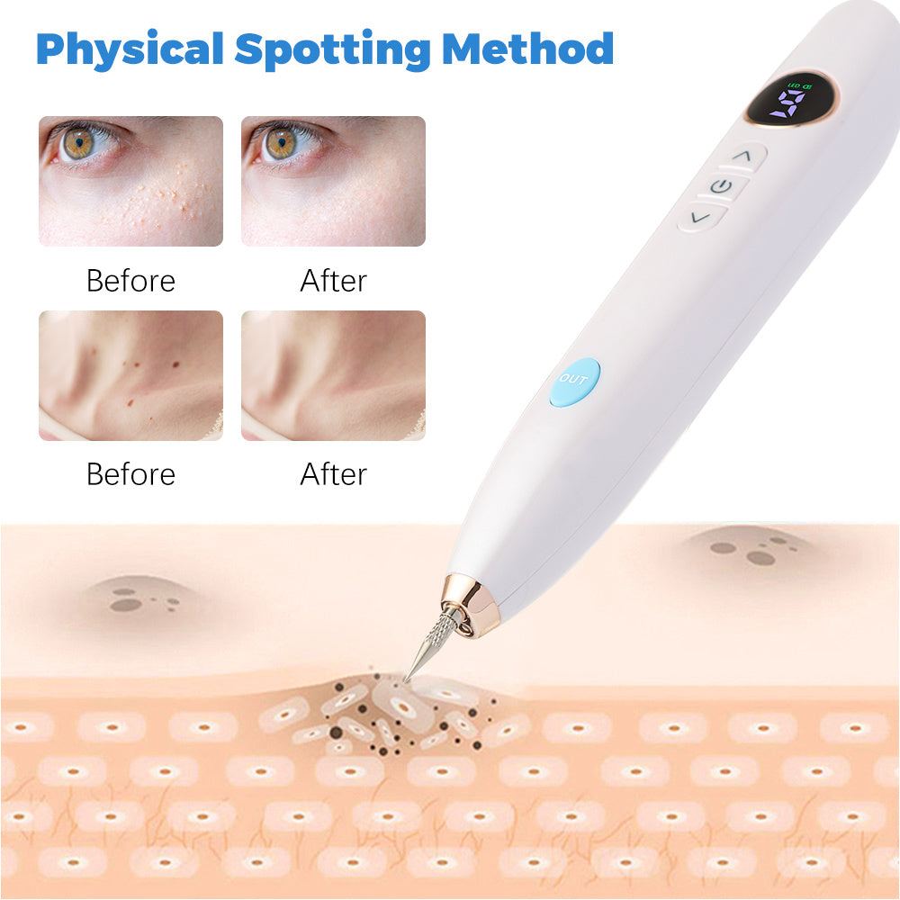 Laser Skin Tag Remover Face Mole Remove Plasma Pen Freckle Removal Machine Plasma Remove Scar Black Spot Face Wart Tattoo Device Laser Skin Tag Remover Face Mole Remove Plasma Pen Freckle Removal Machine Plasma Remove Scar Black Spot Face Wart Tattoo Device